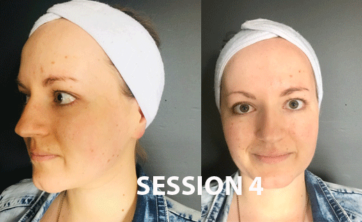 The results after 4 sessions of OMNILUX